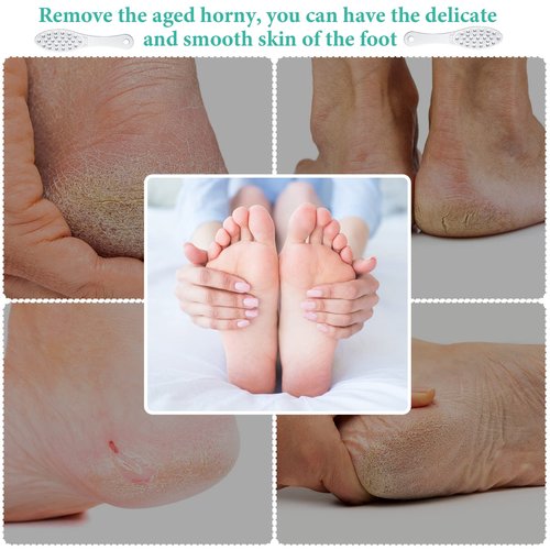 1 Pc Stainless Steel Foot Scraper Metal Foot File Double Sided File Callus Remover Professional Feet Rasp Scrubber for Wet or Dry Skin Easy to Clean Pedicure Tool Heel