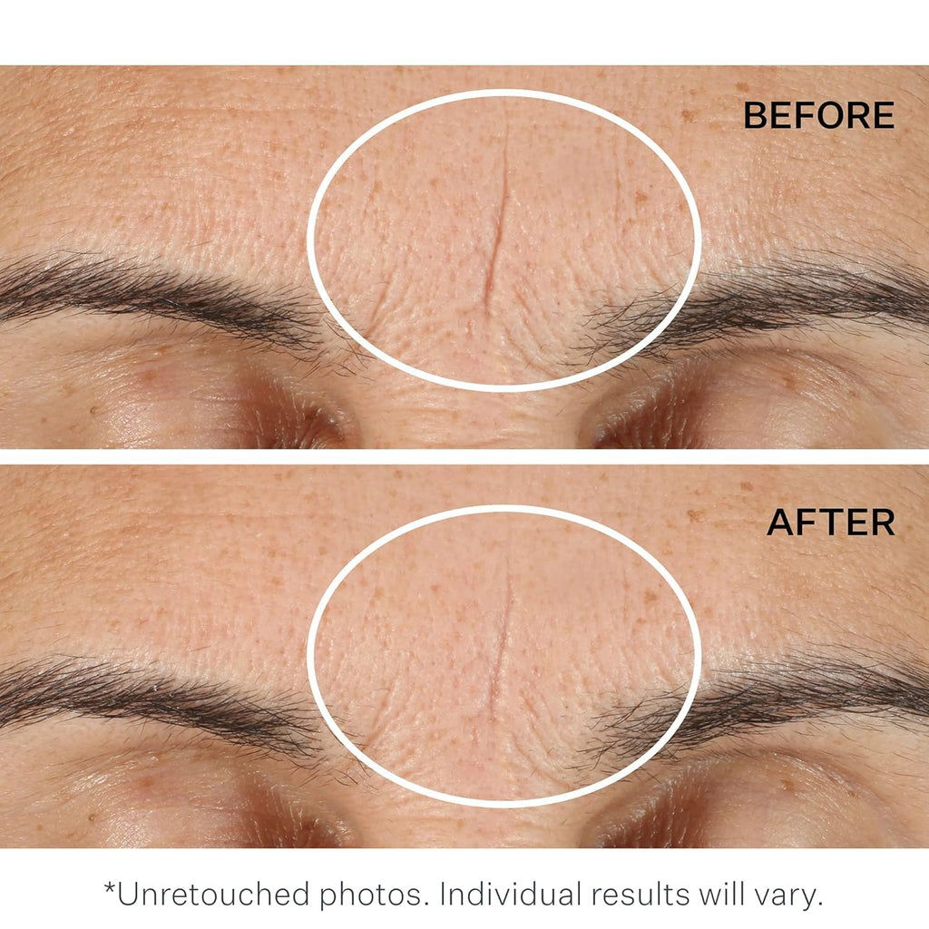 StriVectin Exfoliating Face Pads - Advanced Resurfacing & Instant Wrinkle Blurring Primer