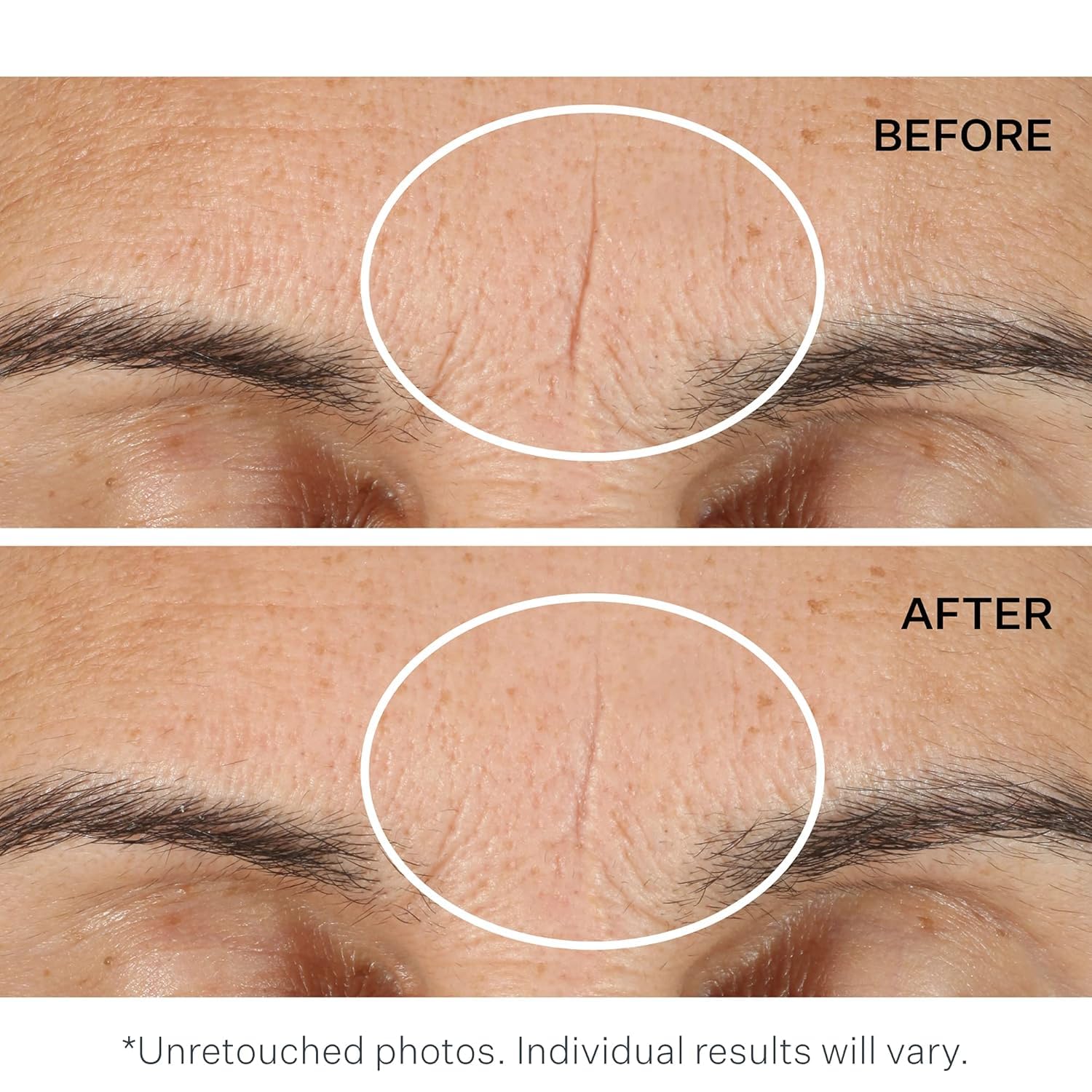 StriVectin Exfoliating Face Pads - Advanced Resurfacing & Instant Wrinkle Blurring Primer