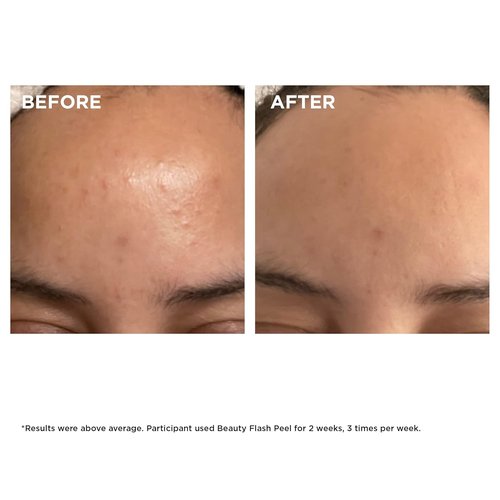Clarins Beauty Flash Peel - 10-Minute At-Home Facial | Tightens Pores & Refines Texture | All Skin Types