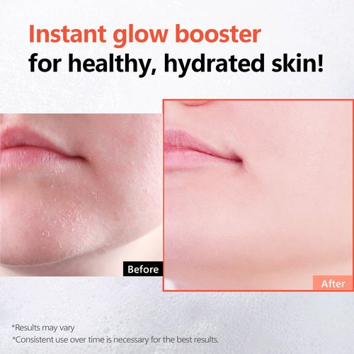 Rice Glow Bubble Toner 3.38 fl oz - Hydrating Milky Toner for Sensitive and Dry Skin, with Niacinamide and Rice Extract to Support Radiant Skin, Easy-to-Carry Size for Daily Korean Skincare Routine
