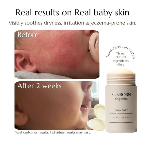 Baby Balm - Natural Moisturizing Stick for Eczema Relief & Diaper Rash | Grass-Fed Tallow, Organic Jojoba & Beeswax | Lab Tested & Baby-Safe, Made in USA