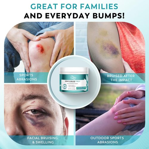 ACLINKI Arnica Bruise Cream for Bruising & Swelling Relief – Arnica Montana with Vitamins K, C & E – Lightweight Non-Greasy Cream for Sensitive & Thin Skin, Face & Body,Fragrance Free, 4.2 oz