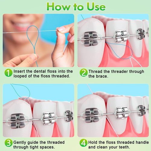 Floss Threaders, Orthodontic Threader, Ultraclean Access Tool for Maintaining Oral Health with Braces, Bridges, and Implants 500 Count (5Pack)