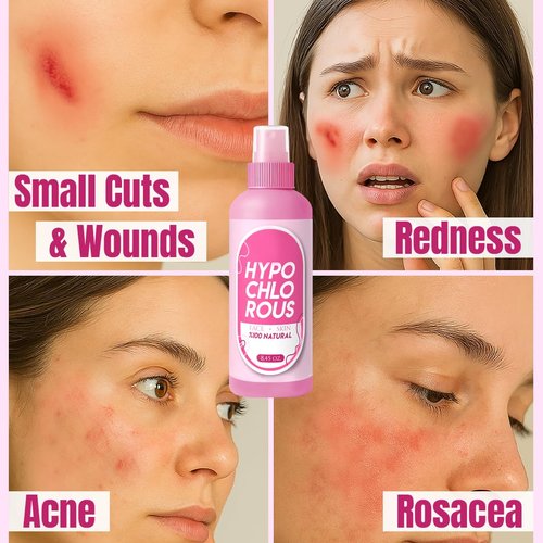 HOCl Hypochlorous Acid Spray Pure 250 ml / 8.4 oz – Natural Skin & Face Mist – Gentle Refreshing Formula for Cleansing, Soothing & Deodorizing – Alcohol-Free & pH Balanced