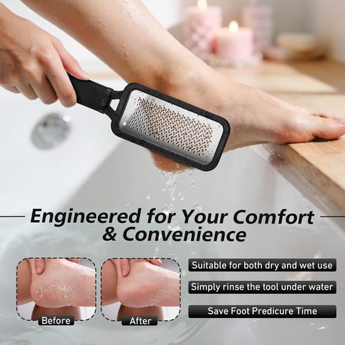BALUCA Professional Foot File & Callus Remover - Stainless Steel Pedicure Tool for Soft Feet | Black