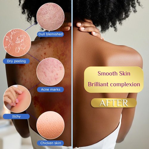 SpiralScgv 6 Pieces African Net Sponge – Effective Deep Cleansing and Exfoliating Mesh for Glowing Skin – Stretchable, Quick-Dry Exfoliating Bath Sponge(Pink, Yellow, Purple, Blue, Black, Off-White)