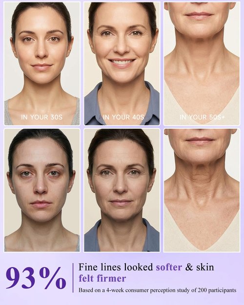 UKVOA Firming Face & Neck Cream - 7% Hyaluronic Acid & Retinol - Anti-Aging Collagen Moisturizer for Mature Women, Day & Night Formula 1.7 oz