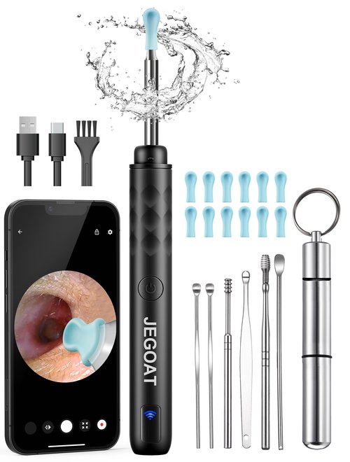 Jegoat Ear Wax Removal, Ear Wax Removal Tool Camera with 1296P HD Camera and 6 LED Lights, Ear Cleaner with 10 Ear Pick, Upgraded Ear Wax Removal Kit for iOS and Android, Black