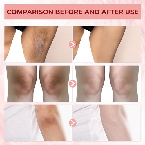 Abera Underarm Dark Spot Corrector Cream with Bearberry Extract, Targeted Armpit Spot Reducer & Sensitive Area Skin Tone Enhancer, Natural Even Tone Solution with Arbutin & Niacinamide