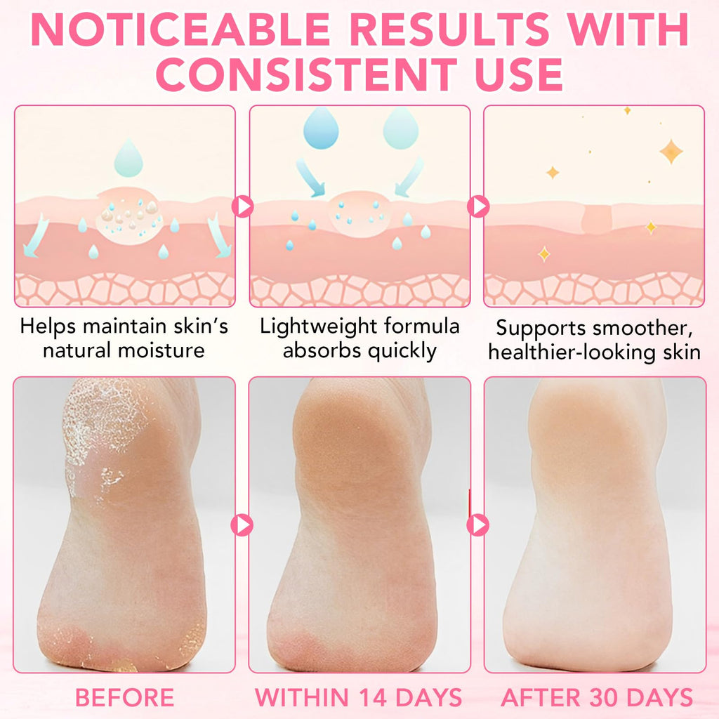 XIAMOFUZHOU 60% Urea plus 2% Salicylic Acid Foot Care Stick, Deep Hydration Soften & Smooth Thickened Areas, Intensive Moisturizer Repairs for Dry, Cracked Heels & Thickened Skin (1.41 Ounce, Peach)