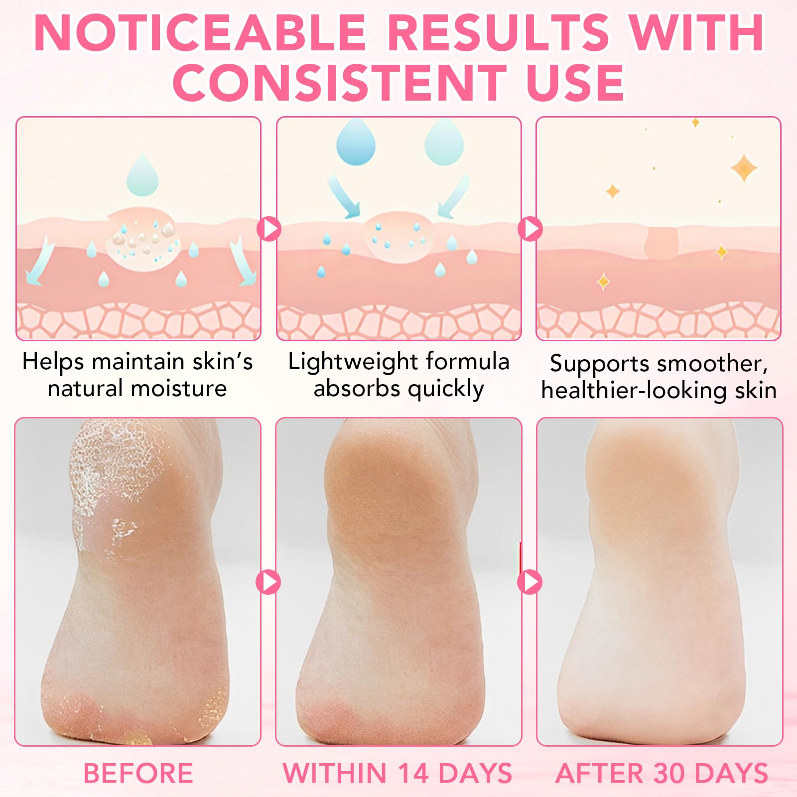XIAMOFUZHOU 60% Urea plus 2% Salicylic Acid Foot Care Stick, Deep Hydration Soften & Smooth Thickened Areas, Intensive Moisturizer Repairs for Dry, Cracked Heels & Thickened Skin (1.41 Ounce, Peach)
