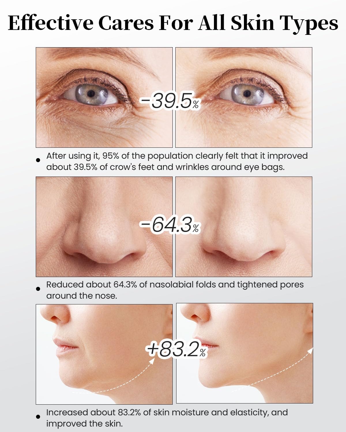 XIAOCHI 4-in-1 Facial Massager for Face & Neck – Skin Rejuvenation, Lifting & Tightening – Reduces Wrinkles & Puffiness, Enhances Infusion