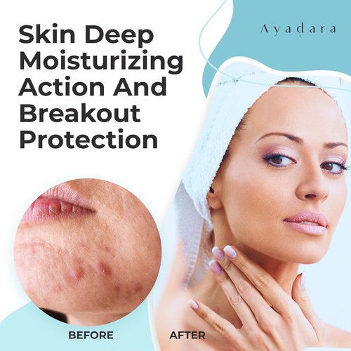 Ayadara Acne Cream - Moisturizing Salicylic Acid Face Moisturizer for Oily Skin | 90-Day Supply