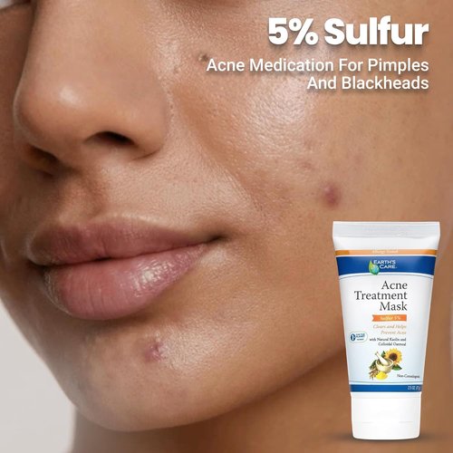 Earth's Care Acne Treatment Mask - 5% Sulfur Formula for Cystic Acne - 2.5 OZ Tube for Clear Skin