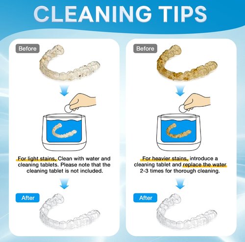 Exluvon Ultrasonic Retainer Cleaner 45kHz, 250ML Portable Jewelry Cleaner, Professional Retainer Cleaner Machine for Denture, Mouth Guard, Aligner