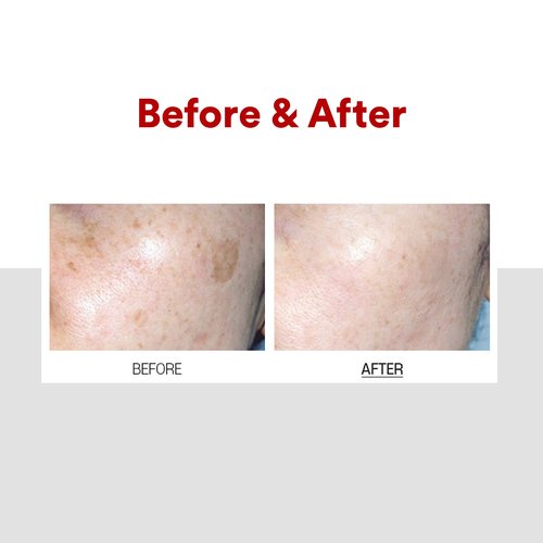 Medi-Peel Melanon X Cream 1.01 fl oz, Reduce Dark Spots, Anti-Aging, Spot Cream, Spot Treatment, Skin Trouble Care, Brightening, Moisturizing, Blemish & Freckles, Korean Skin Care