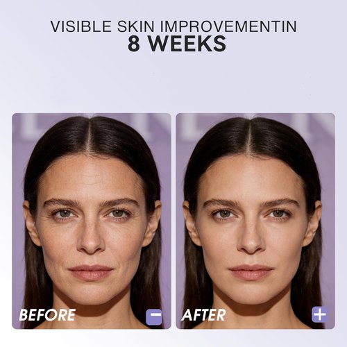 Micro-Infusion System for Face,Mirco System Serum applicator for Face,3-Month-supply(3* applicator+9*Serum)
