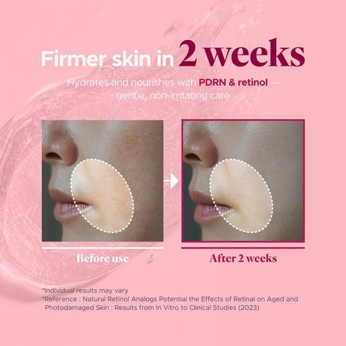 it:fu Blending Collagen UpTox Ampoule | Salmon DNA Ampoule & Copper Peptides Face Serum | Anti-Aging, Wrinkles, Dark Spot Correcting & Instant Lift | Retinol & Retinal (1.01 oz)