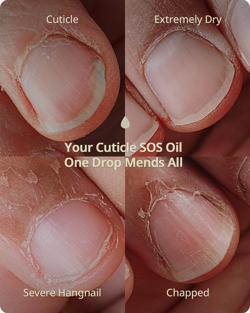 BTARTBOXNAILS Nutri-Forte Cuticle Oil - Deep Repairing Formula with Olive Oil & Vitamin E, 15ml
