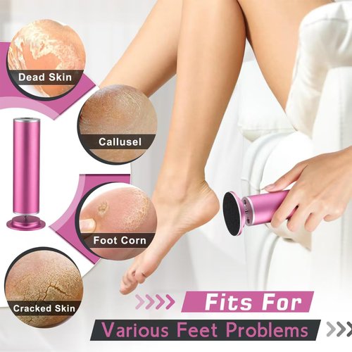 Electric Foot Callus Remover,Callus Remover for Feet,with 60pcs Sanding Disc,Electric Speed Adjustable Foot File for Dead Skin Cracked Skin Calluses for Men and Women