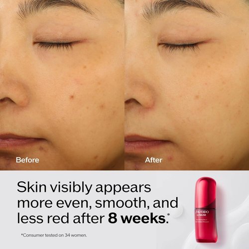 Shiseido Ultimune Power Infusing Serum - Essential Energy Hydrating Cream Set | 1.6 oz & 50 mL