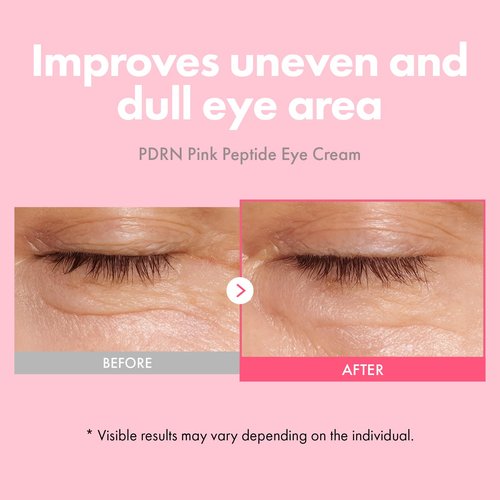 TOSOWOONG PDRN Pink Peptide Eye Cream with Salmon DNA PDRN 5,000ppm, Anti Aging Formula with Caffeine & Liposome Retinol for Fine Lines, Dark Circles and Wrinkles, Korean Skincare, 30ml / 1.01 fl.oz.