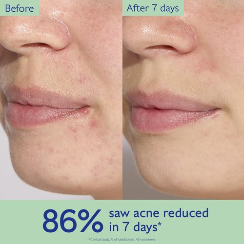 Caudalie Vinopure Acne Treatment - Salicylic Acid Serum for Blemish Prevention | 30 mL