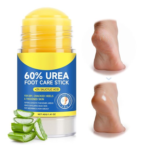 Regine Switzerland 60% Urea Cream Stick - Maximum Strength Foot Cream with 2% Salicylic Acid for Dry, Cracked Heels | Rapid Callus Remover
