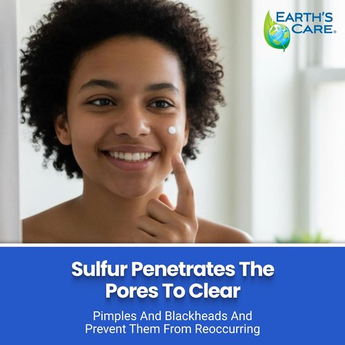 Earth's Care Acne Spot Treatment - 10% Sulfur Cream for Cystic Acne, Pimples & Blackheads | 0.97 OZ Tube
