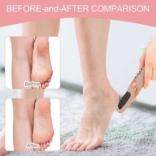 LQT® Electric Foot File – Rechargeable Callus Remover for Hard, Cracked Skin – At-Home Pedicure Kit for Smooth Feet (Men & Women) (Pink)