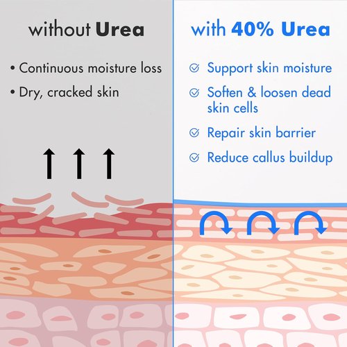 Ebanel Urea Cream 40% with Salicylic Acid - Intensive Foot Cream for Dry Cracked Skin | 4 Oz