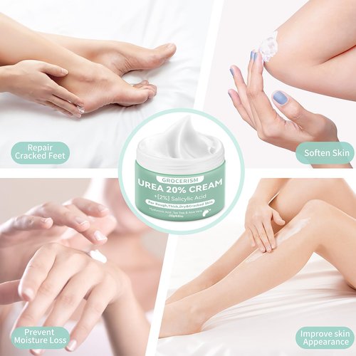 Grocerism Urea Cream 20 Percent For Feet Plus 2% Salicylic Acid 8.82 oz || Foot Cream and Hand Cream Maximum Strength with Hyaluronic Acid, Tea Tree, and Aloe Vera for Deep Moisturizes, Callus Remover