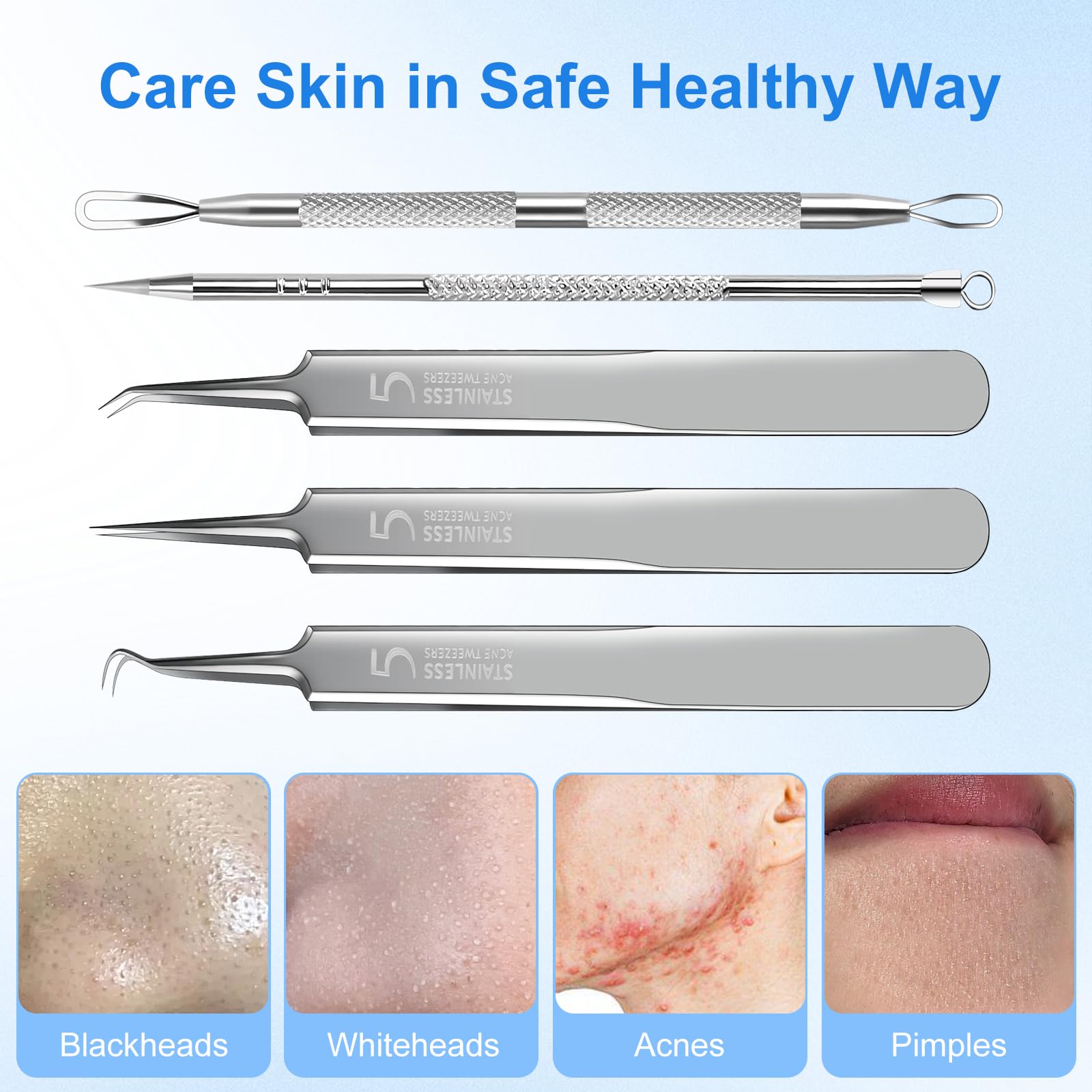 YGQQOY Blackhead Remover Tweezers, Pimple Popper Tool Kit, Ingrown Hair Tweezers, Blackhead Extractor, Skin Zit Acne Blemish Popping Removing Surgical Tweezers Tools for Nose Eye Face