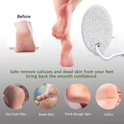 8-Pack Foot Pumice Stone for Feet, Borogo Natural Lava Pedicure Tools Hard Skin Callus Remover for Feet and Hands