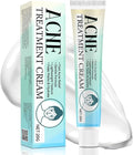 Acne Treatment for Face, Acne Cream, Pimple Cream Suitable for All Skin, Blemish Care Cream for Face and Body, Gentle Daily Skin Care for Oily & Blemish-Prone Skin, Helps Improve Skin Appearance