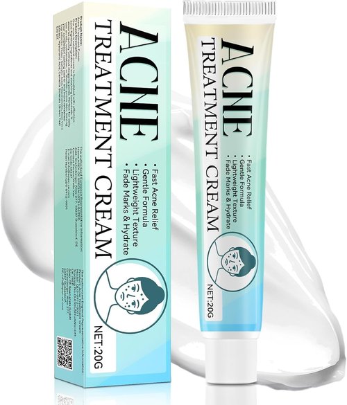 Acne Treatment for Face, Acne Cream, Pimple Cream Suitable for All Skin, Blemish Care Cream for Face and Body, Gentle Daily Skin Care for Oily & Blemish-Prone Skin, Helps Improve Skin Appearance