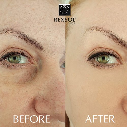 REXSOL Retinol + Vitamin C Anti-Aging Cream | Effective Night Face Care & Dark Spot Remover | Anti-Aging Neck Cream & Wrinkle Cream That Truly Works | Infused with Vitamin E, A - 2 OZ