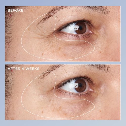 Perricone MD High Potency Triple Retinol Renewal Eye Serum, 0.5 fl. oz.