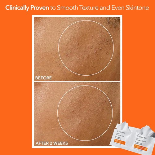 Dr. Dennis Gross Alpha Beta Daily Peel - Smooth Uneven Tone & Texture | 60 Treatments