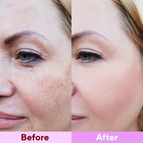 Nityrliv Collagen Face Mask, 4 Pack Bio-Collagen Real Deep Mask Overnight Hydrating Face Mask for All Skin Types,Original Hydrating Collagen Face Mask