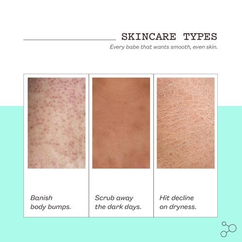Frank Body Glycolic Acid Body Scrub - Fights KP, Breakouts & Tightens Pores | 8.82 oz | Soothes with Witch Hazel