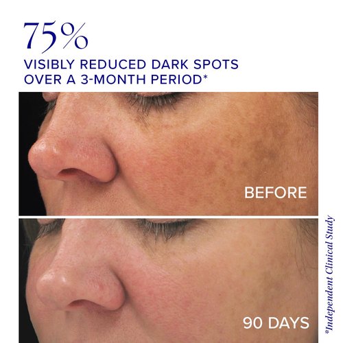 iS CLINICAL Brightening Complex - Skin Brightening Treatment for Age Spots & Uneven Tone