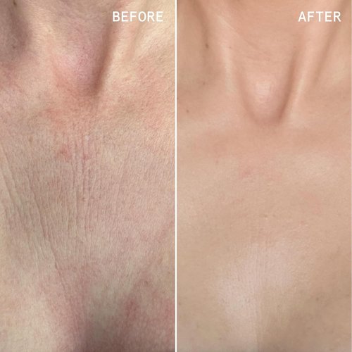 Beauty Pie Über Youth Neck & Chest Tightening Serum Spray - Firming Anti-Aging Formula | 3.2 fl oz