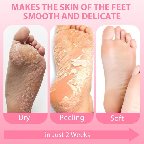 Nacerlary 4 Pack Foot Mask, Deep Exfoliation for Smooth Feet, Gentle Yet Effective Formula, Foot Mask for Removes Dead Skin and Calluses, Suitable for Men & Women, Peach Scent