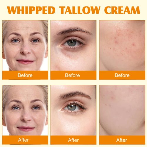 Meifenla Beef Tallow for Skin, Tallow and Honey Cream Natural Tallow Face Moisturizer,Hydrating Beef Tallow Balm Deeply Moisturizing for Face & Body Skin Care