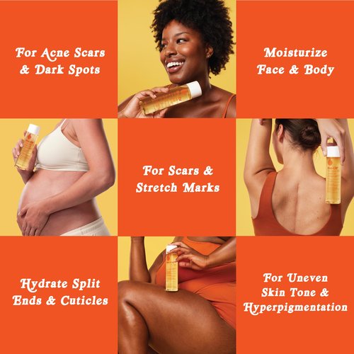 Bio-Oil Natural Skincare Oil Serum, Face and Body Moisturizer with Chamomile, Rosehip, and Lavender Oil, for Scars, Stretch Marks, Sensitive Skin, All Skin Types, 0.85 Oz, Pack of 3