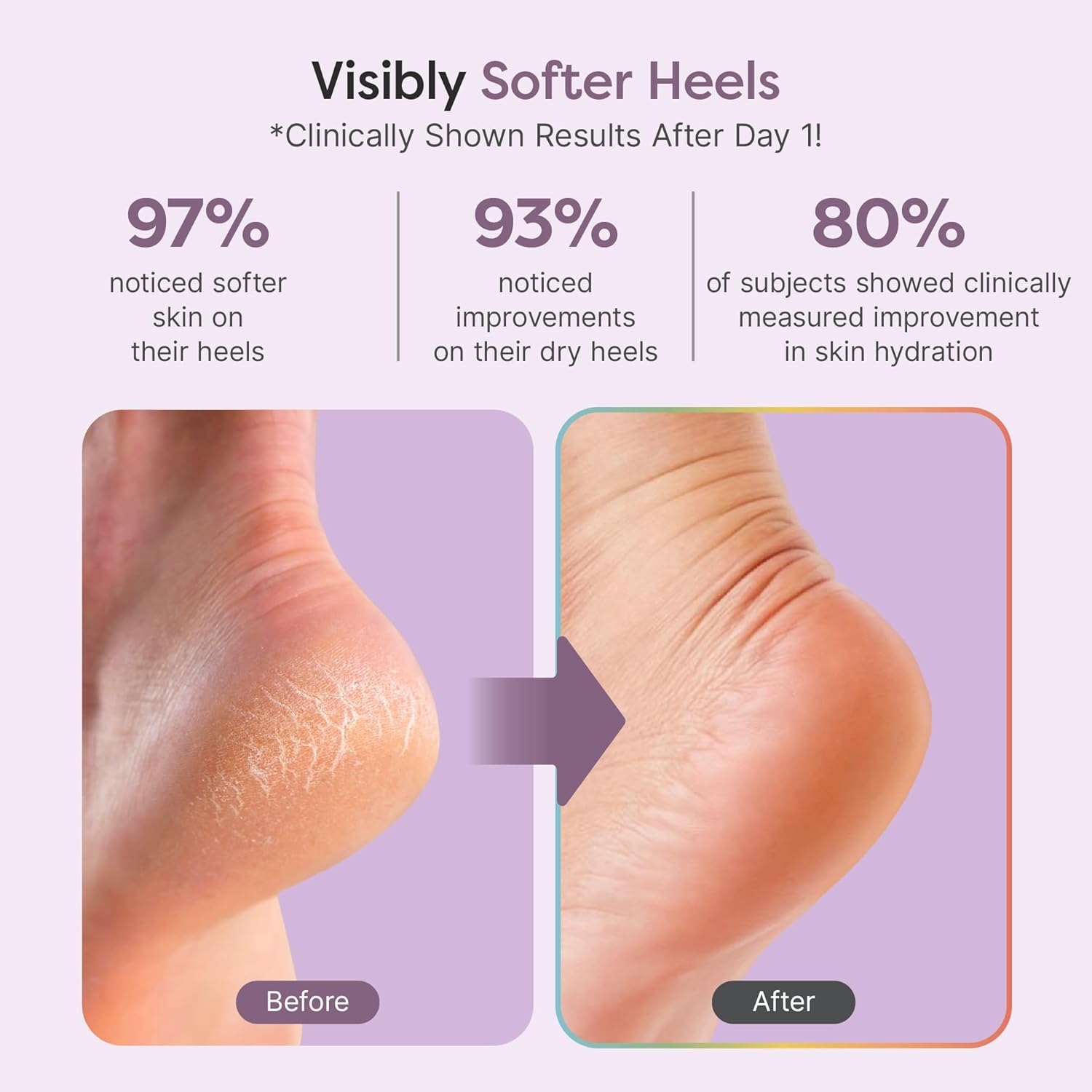 ZenToes Natural Foot Balm - Hydrating Cream for Dry, Cracked Heels & Feet | Enriched with Coconut & Tea Tree Oils | 2oz