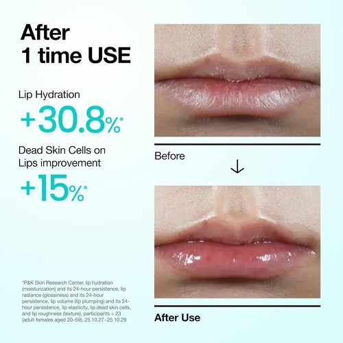 Anua PDRN Lip Serum - Long-Lasting Hydration for Dry Lips | Non-Sticky Moisturizing Formula, 0.33 fl. oz