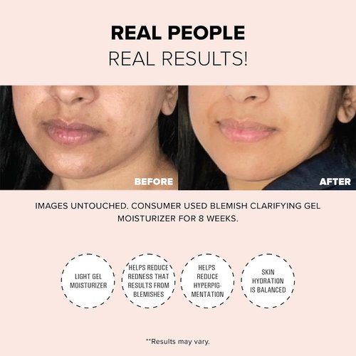 Nudestix Blemish Clarifying Gel Moisturizer - Lightweight Salicylic Acid Acne Treatment with Niacinamide & Cica | Hydrating Vegan Daily Face Moisturizer for Clear Skin